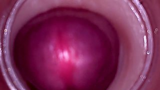 Female Insemination - Internal Camera Captures Deep Male Ejaculation