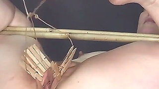 Staples Badly Removed