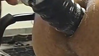 Extreme Fisting