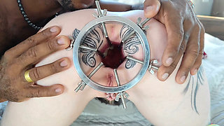 ANAL DILATION MAKES MY ASS FOLDS BURST