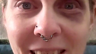 Hurting My Own Bruise