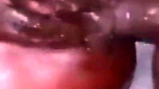 Deep Anal Penetration: Too Much for Me